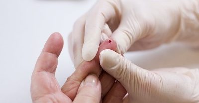 Toshiba desarrolla aparato que podría detectar cáncer con solo una gota de sangre