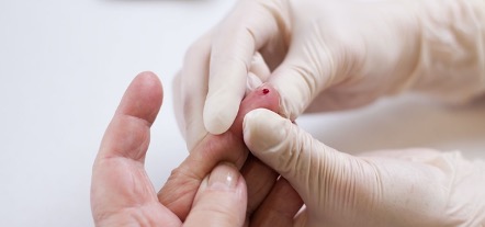 Toshiba desarrolla aparato que podría detectar cáncer con solo una gota de sangre